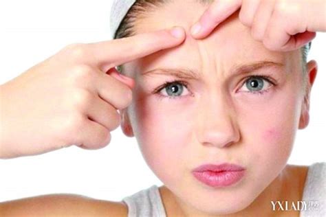 【图】脸经常浮肿是什么原因是什么 揭示脸肿背后的原因(2)_脸经常浮肿是什么原因_伊秀美容网|yxlady.com