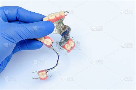 整形牙医。可拆卸义齿的修复概念。牙医戴着手套的手在上下颌上托着一套带钩的义齿。光背景