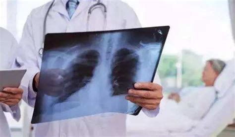 肺部有结节的人最怕三个征兆，可以进行自我检查吗_北京崇文中方中医医院