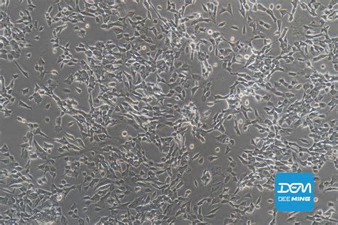 Nature 子刊：单细胞测序揭示前列腺癌转移相关分子机制，生物信息挖掘单细胞数据金矿