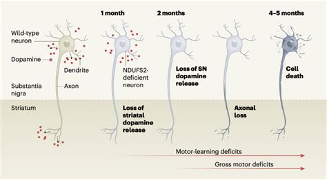 《自然》：帕金森病获多项重大突破！科学家首次证实，多巴胺能神经元线粒体损伤足以使小鼠产生类似人类PD的症状丨科学大发现|基因_新浪新闻