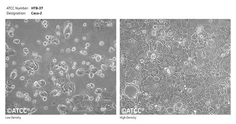 CACO2细胞（人结直肠腺癌细胞）培养注意事项-上海传秋生物科技有限公司