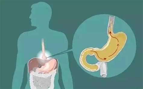 胃粘膜损坏严重，会有4种表现！3种方法修复胃粘膜，胃越来越好！