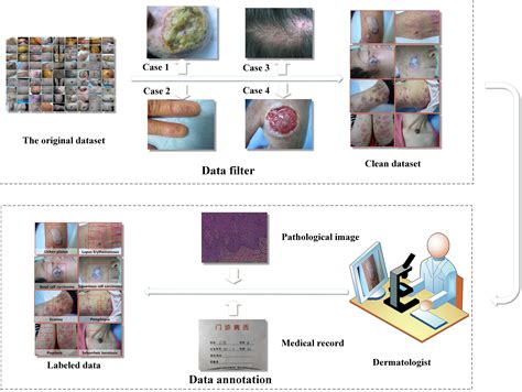 皮肤病送检诊断重新定义，新升级 新形式_拓瑞检测