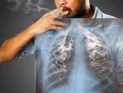 老烟民成功戒烟后，肺还能恢复正常吗？医生告诉你最佳的戒烟年龄 - 知乎