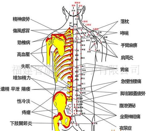 教学模型_股骨头和肌肉脊柱模型 活动脊柱 可弯曲骨骼 - 阿里巴巴