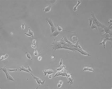 4T1细胞;小鼠乳腺癌细胞_小鼠源_细胞系_U平台商城-普拉特泽生物 - Powered by ECShop