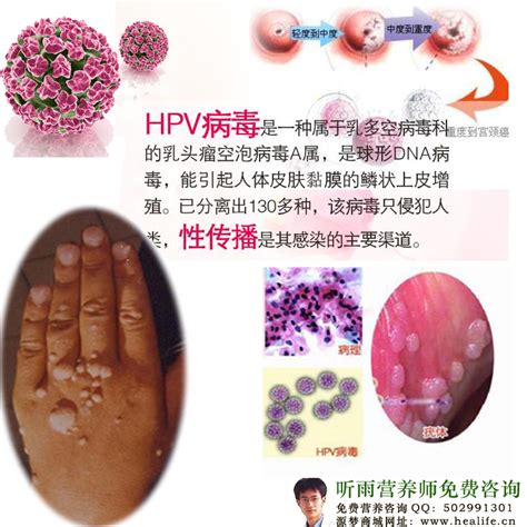 感染HPV图片,pv丘疹图片,pv症状图片_大山谷图库