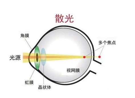 散光图图片
