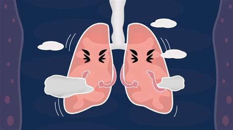 肺癌早期临床症状 肺癌早期的临床症状有哪些 - 学堂在线健康网