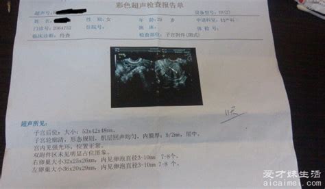 男子做彩超显示子宫卵巢未见异常 院方致歉(图)-搜狐新闻