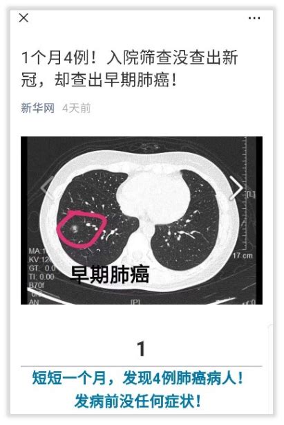 【标准与规范】中国肺癌筛查标准（T／CPMA 013-2020）_中华
