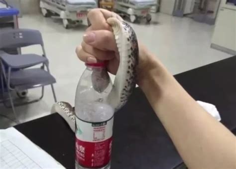 浙江省金华市浦江县女子被蛇咬伤 徒手捉1.5米大蛇自行求医 - 神秘的地球 科学|自然|地理|探索