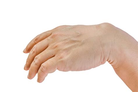 手上有青筋，或隐藏疾病，手部这4个部位有青筋，要注意