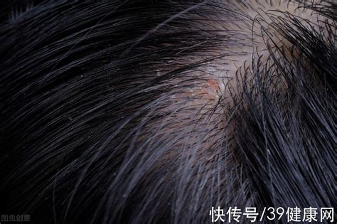 头皮上长疙瘩图片
