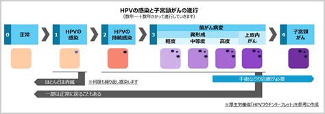 がんと感染 ～ヒトパピローマウイルス（HPV）～ | 2020年 | コラム | ニュース一覧 | 一般財団法人 浜松光医学財団 浜松PET ...