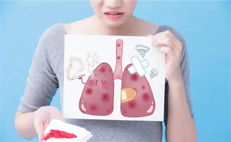 肺癌的15个征兆 肺癌的早期症状和前兆 肺癌晚期症状→MAIGOO生活榜