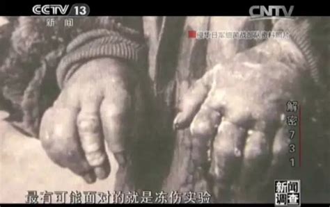 惨绝人寰！日本电视台再次自揭731部队罪行-新闻中心-温州网