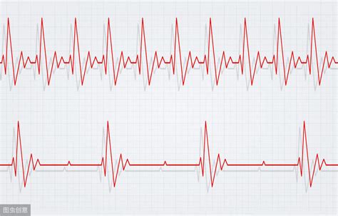 心率不齐是什么感觉-心率不齐的症状介绍-六六健康网