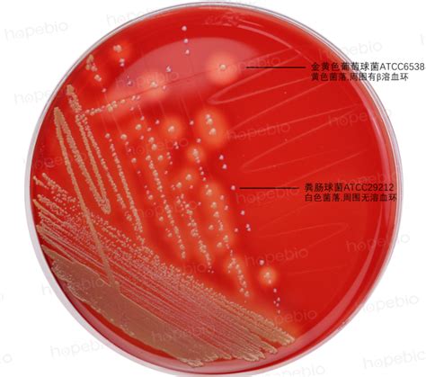 检验报告丨流感嗜血杆菌的流行病学特征与临床治疗！_标本