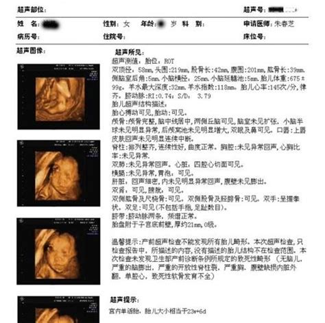 【怀孕b超单】【图】怀孕b超单全解析 教你看懂孕期B超单_伊秀亲子|yxlady.com