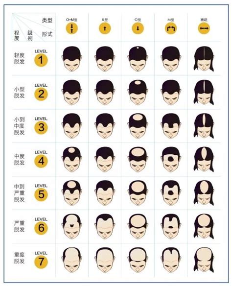 【图】人类每天掉多少头发算正常 护发须吃的食物和护理(3)_伊秀美容网|yxlady.com