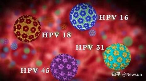 低危型HPV病毒会发展为高危型吗？ - 知乎