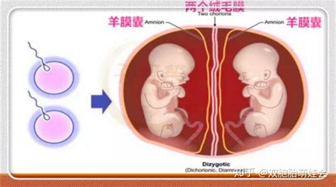 双胎、多胎和联胎_《组织学与胚胎学》在线阅读_【中医宝典】