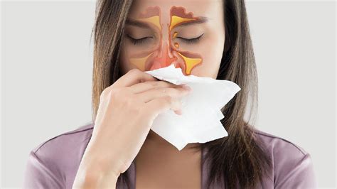 鼻窦炎能根治吗 鼻窦炎的治疗方法都有哪些-鼻窦炎治疗-复禾健康