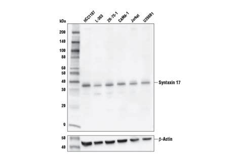 Syntaxin 17 Antibody | Cell Signaling Technology