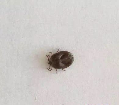 蜱虫咬人后的图片