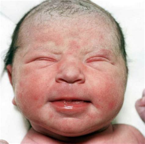 婴儿刚出生（新生儿的真实照片）-幼儿百科-魔术铺