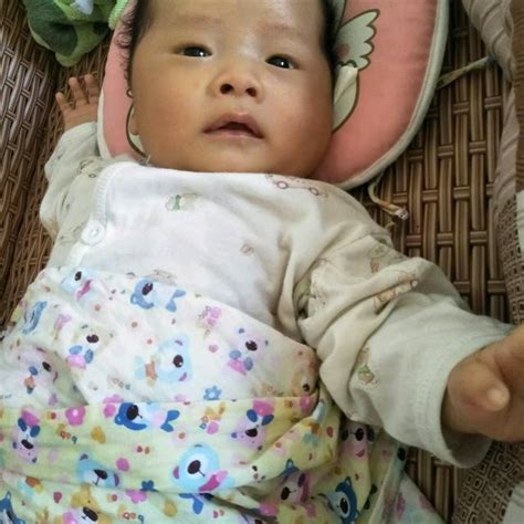 唐氏儿吐舌头图片