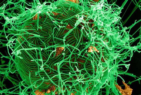 埃博拉病毒能治好吗 感染埃博拉病毒有什么症状 _八宝网