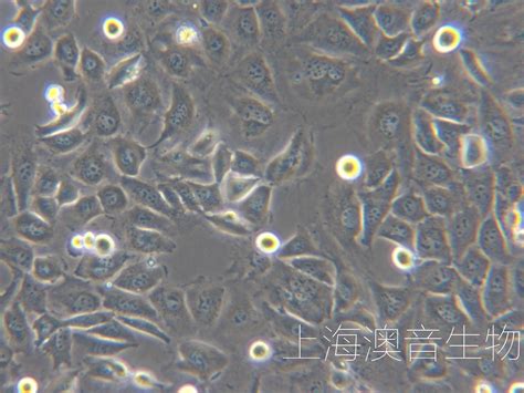 科学家阐释了人类血细胞生成的新原理----中国科学院广州生物医药与健康研究院