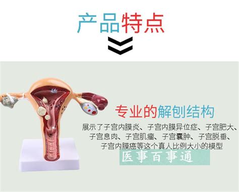 人体模型女性生殖子宫模型阴道卵巢模型教学模具病理变化科学教具-阿里巴巴