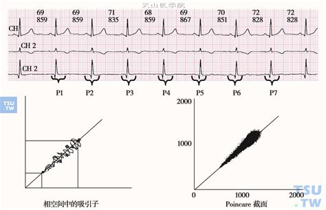 正常的心率图的波形,正常的心率曲线图,正常心率图_大山谷图库