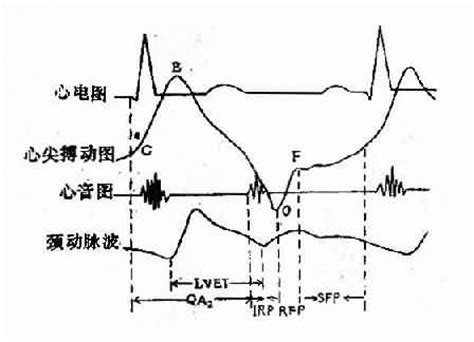 心电生理学 - 心电图上的心动周期（P-QRS-T波）……|医学_新浪新闻