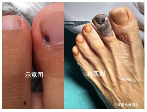 脚底发黑图片