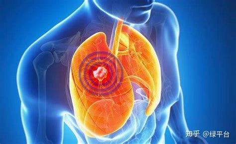 代华平：间质性肺疾病遇到新冠肺炎的挑战与对策丨新冠疫情下的新思考（3）-新冠-呼吸界