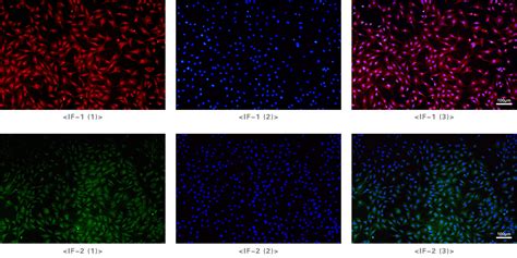 活检样本结合Phenoptics多色免疫荧光方案揭示黑色素瘤免疫微环境-云准医药科技（上海）有限公司