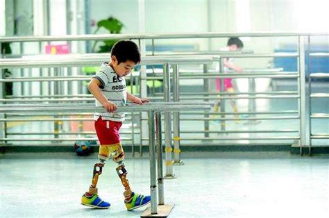 科技赋能新生，给残疾人装上智能手，上海启动“乐善助残 最好有手”公益活动_视觉 _ 文汇网