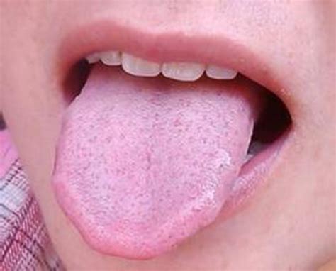 舌头图片