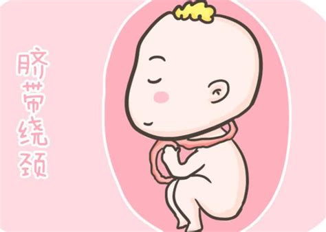 孕期有这3个行为，容易导致胎儿脐带绕颈，孕妈别只顾着自己舒服 - 知乎