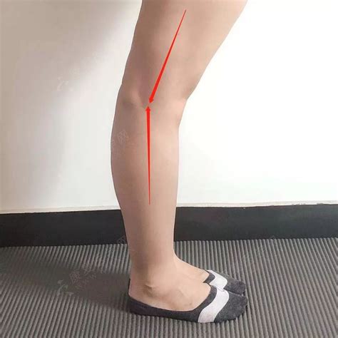 大腿内侧图片
