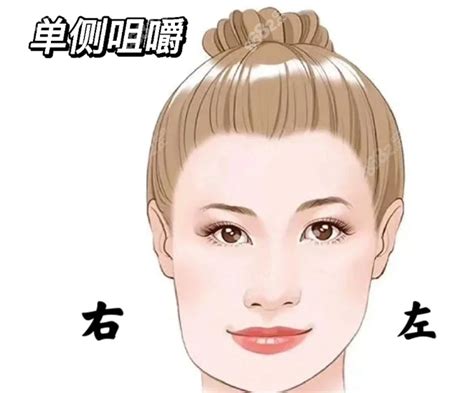 轻微嘴歪图片