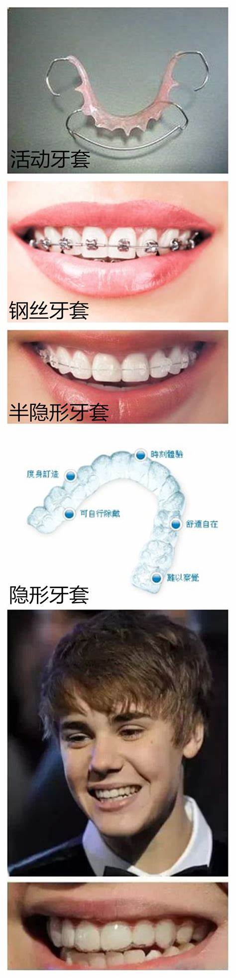 牙套和牙冠的区别