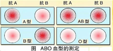 ABO血型系统的抗原及抗体