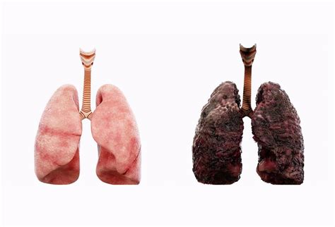 远离烟毒 珍爱生命 - 吸烟者的肺图片