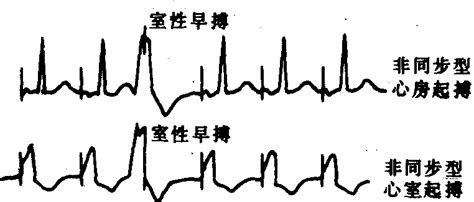 右心房位置图,心肺图位置图,心胀位置图_大山谷图库